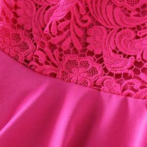 Stitching Lace Dress J707dh